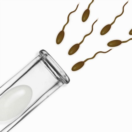 Sperm Cost 