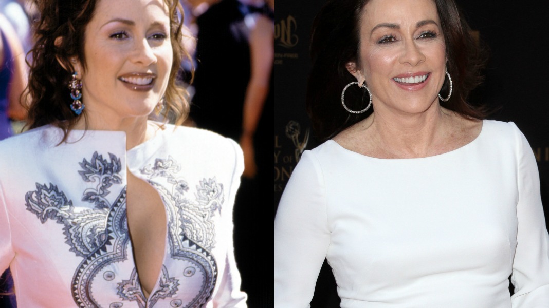 breast reduction 