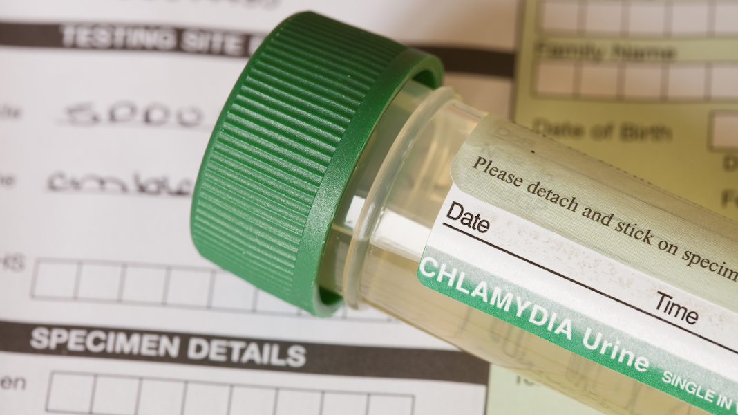 std testing