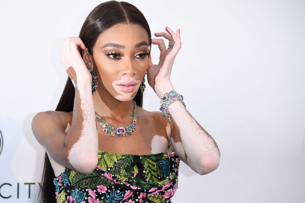 Winnie Harlow Poses At The Cannes Gala