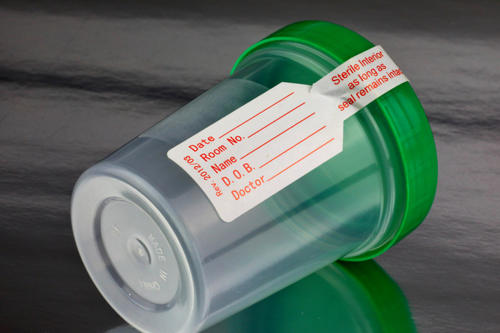 urine analysis