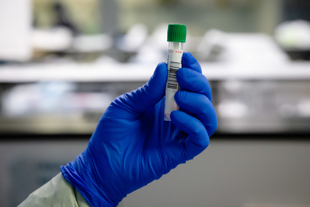 A view of a test tube with swab sample performed on a...