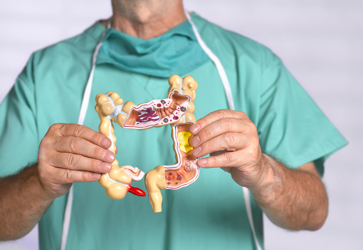 colon cancer