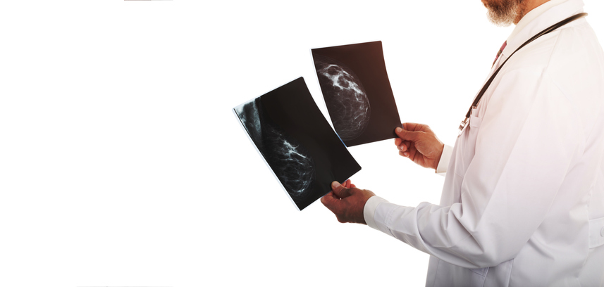 Doctor looking at a mammography