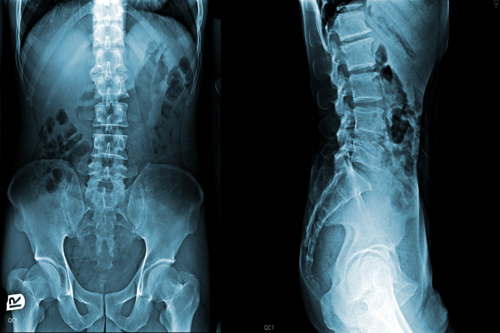 Film x-ray of medical use, X-Ray Technology