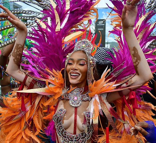 Carnival, Jamaica, Jamaican, vitiligo, Winnie Harlow, model, fete, Jouvert, Kingston, fans