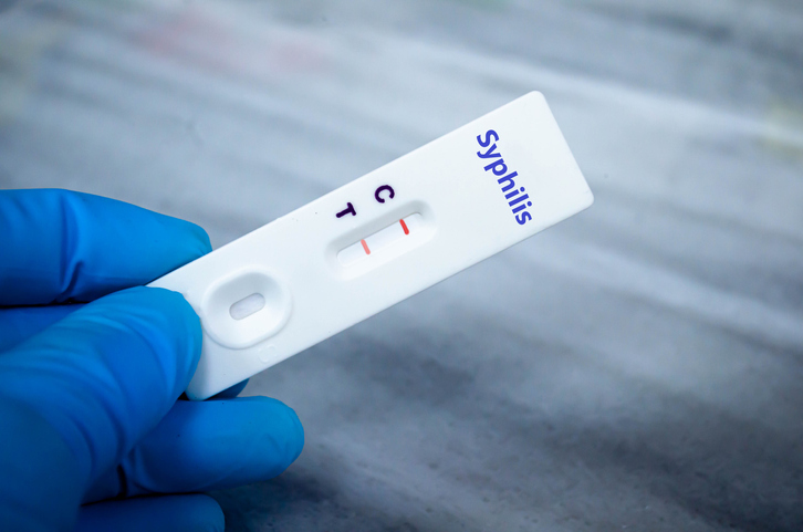 disease, Black, Black women, prevention, health, increase, case, congenital syphilis, infections, STI, syphilis