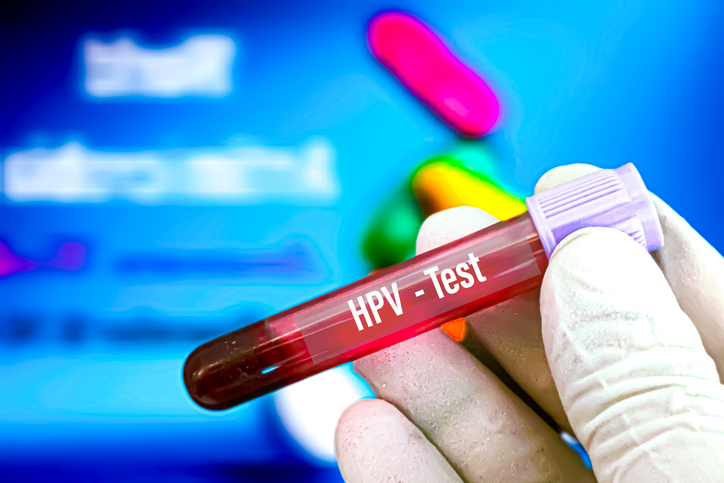 Blood sample for (HPV) Human Papilloma Virus test at medical laboratory.