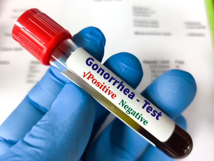 Biological specimens STD panel testing concept.